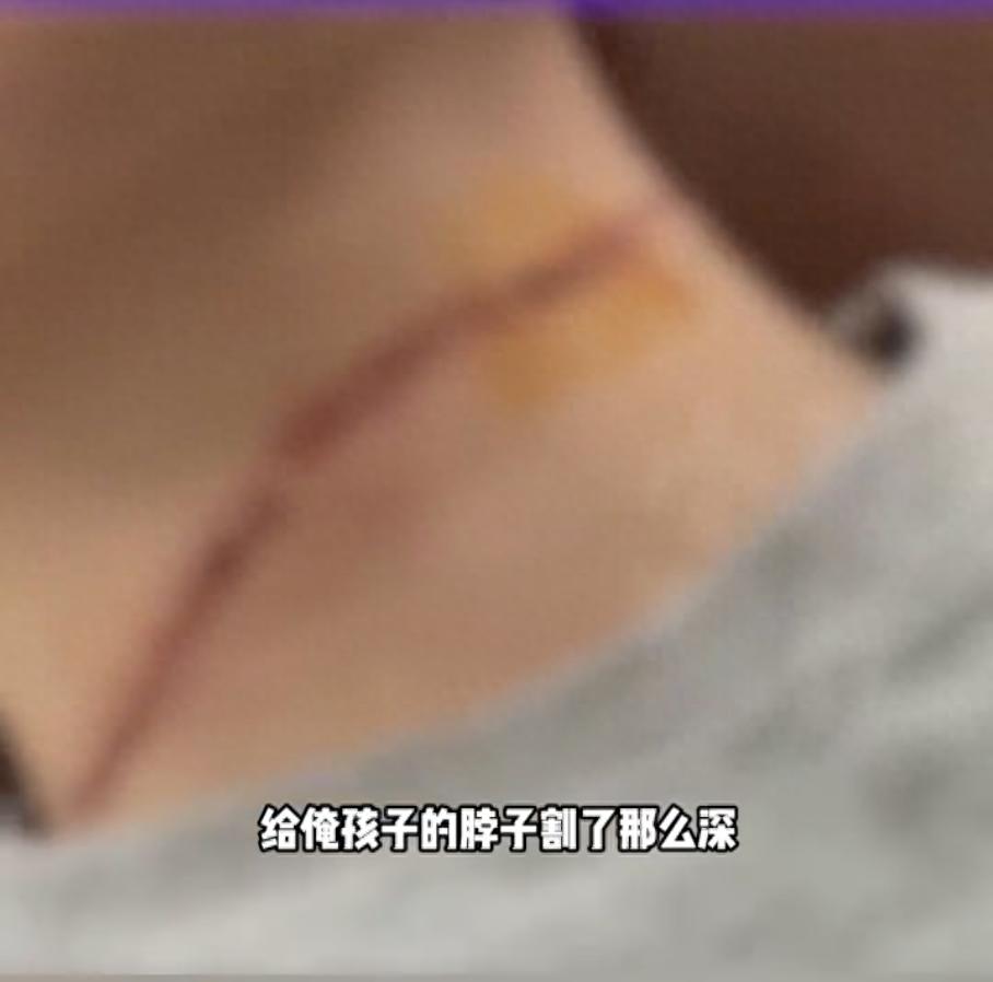连发多起！有人惨遭“割喉”，最近正是高发期！