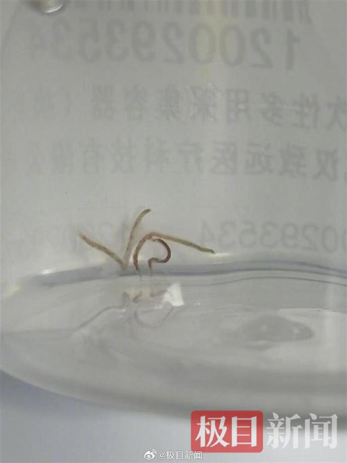 老人赤脚种菜种出一肚子虫