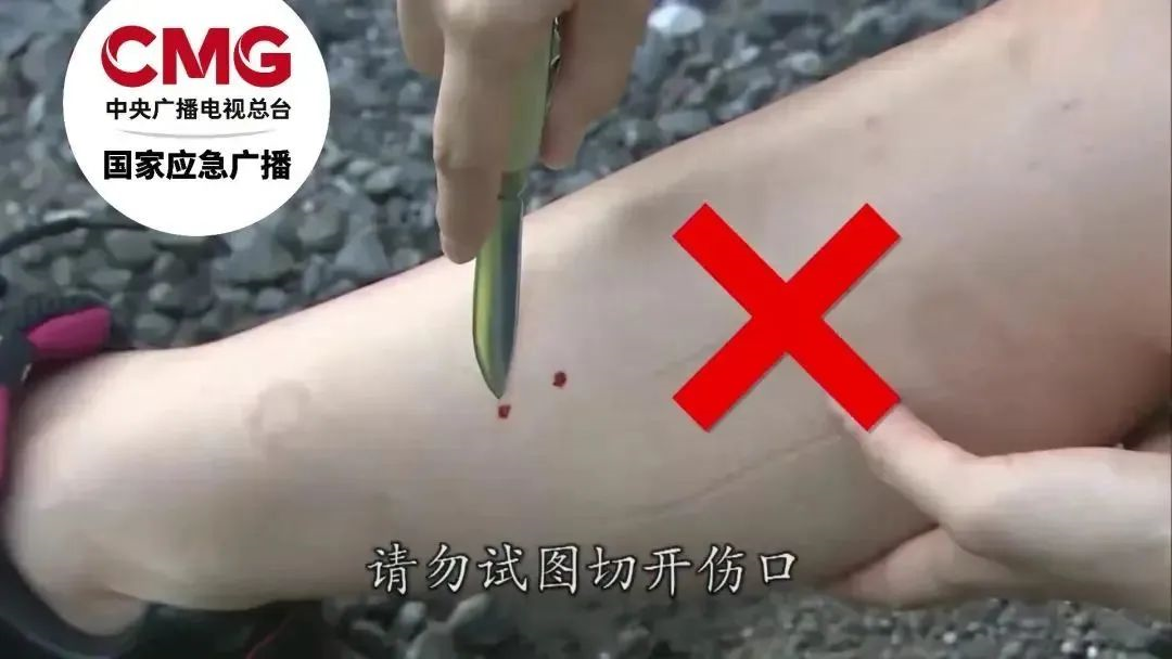 痛心！27岁女子被不明物咬伤后身亡，紧急提醒