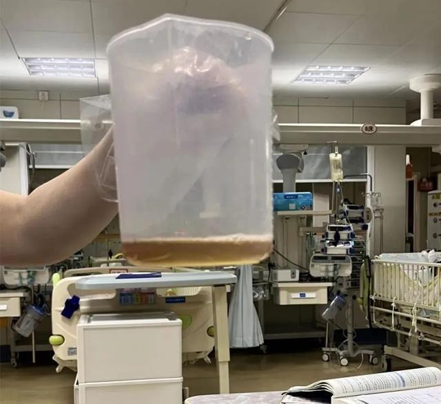 广东5岁男孩吃1包坚果住进ICU！只因含有“它”