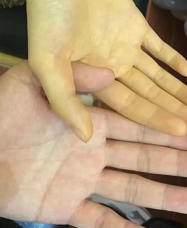 广东5岁男孩吃1包坚果住进ICU！只因含有“它”
